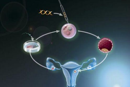 体外受精 IVF-ET